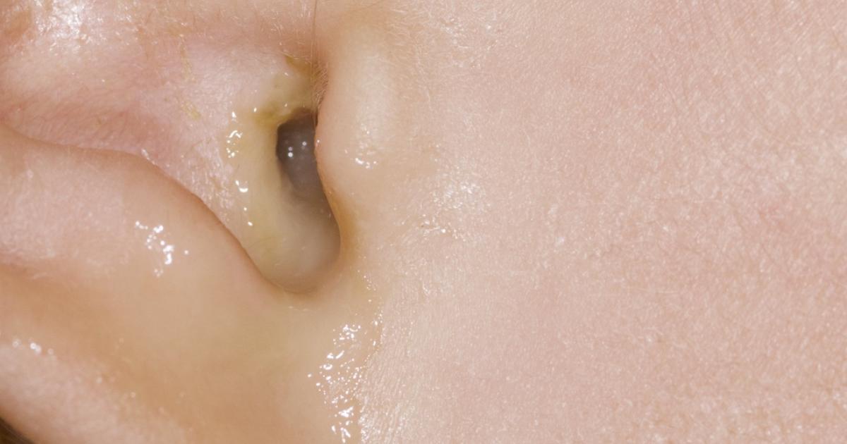 Een acuut loopoor NTvG